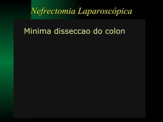 Nefrectomia Laparoscópica 