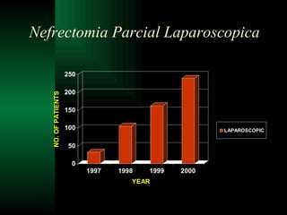 Nefrectomia Parcial Laparoscopica 