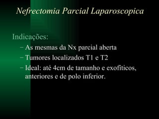 Indicações: As mesmas da Nx parcial aberta Tumores localizados T1 e T2 Ideal: até 4cm de tamanho e exofíticos, anteriores e de polo inferior. Nefrectomia Parcial Laparoscopica 