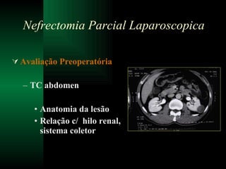 Avaliação Preoperatória TC abdomen Anatomia da lesão Relação c/  hilo renal, sistema coletor Nefrectomia Parcial Laparoscopica 