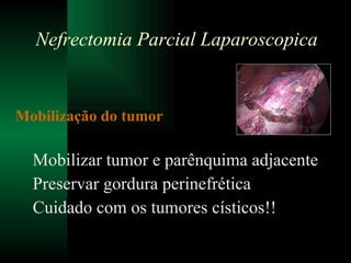 Mobilização do tumor Mobilizar tumor e parênquima adjacente Preservar gordura perinefrética Cuidado com os tumores císticos!! Nefrectomia Parcial Laparoscopica 