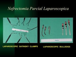 Nefrectomia Parcial Laparoscopica LAPAROSCOPIC  BULLDOGS LAPAROSCOPIC  SATINSKY  CLAMPS 
