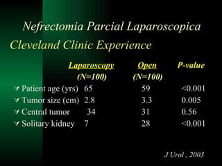 Cleveland Clinic Experience     Laparoscopy   Open   P-value   (N=100)   (N=100) Patient age (yrs)   65   59   <0.001 Tumor size (cm)   2.8   3.3    0.005 Central tumor  34   31   0.56 Solitary kidney   7    28   <0.001 J Urol , 2003 Nefrectomia Parcial Laparoscopica 