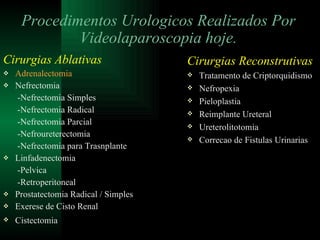 Cirurgias Ablativas Adrenalectomia Nefrectomia   -Nefrectomia Simples    -Nefrectomia Radical   -Nefrectomia Parcial   -Nefroureterectomia   -Nefrectomia para Trasnplante Linfadenectomia    -Pelvica   -Retroperitoneal Prostatectomia Radical / Simples Exerese de Cisto Renal Cistectomia   Procedimentos Urologicos Realizados Por Videolaparoscopia hoje. Cirurgias Reconstrutivas Tratamento de Criptorquidismo Nefropexia Pieloplastia Reimplante Ureteral Ureterolitotomia Correcao de Fistulas Urinarias 