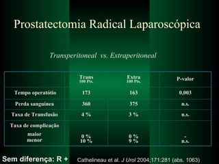 Prostatectomia Radical Laparoscópica  Transperitoneal  vs. Extraperitoneal Cathelineau et al.  J Urol  2004;171:281 (abs. 1063)  Sem diferença: R + - n.s. 0 % 9 % 0 % 10 % Taxa de complicação maior menor n.s. 3 % 4 % Taxa de Transfusão n.s. 375 360 Perda sanguínea 0,003 163 173 Tempo operatótio P-valor Extra 100 Pts. Trans 100 Pts. 