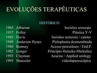EVOLUÇÕES TERAPÊUTICAS HISTÓRICO 1903  Albarran  Incisões ureterais  1937  Folley  Plástica Y-V 1943  Davis  Incisões ureterais / cateter  1949  Anderson Hynes  Pieloplastia desmembrada 1980  Ramsey  Acesso percutâneo / End.P. 1982  Lenger Princípio Heineke-Mickulicz 1993  Clayman  Acucise / Applied urology  1993  Shuessler  videolaparoscópica  