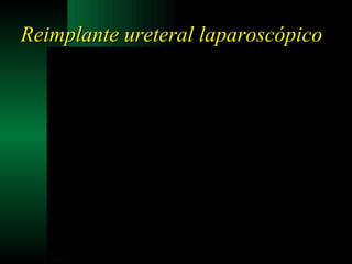 Reimplante ureteral laparoscópico 