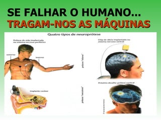 SE FALHAR O HUMANO...  TRAGAM-NOS AS MÁQUINAS 