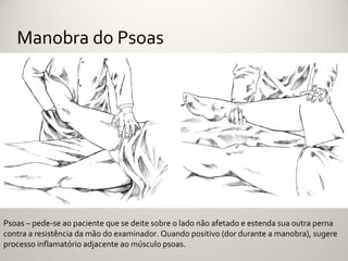 Manobra do Psoas




Psoas – pede-se ao paciente que se deite sobre o lado não afetado e estenda sua outra perna
contra a resistência da mão do examinador. Quando positivo (dor durante a manobra), sugere
processo inflamatório adjacente ao músculo psoas.
 