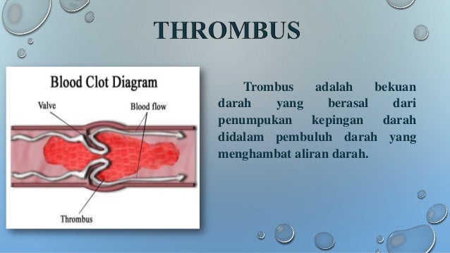 Termin 4