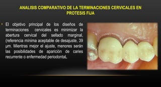Terminaciones Cervicales en PFIJA. dentalppt | PPT
