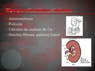  Asintomáticos
 Poliuria
 Cálculos de oxalato de Ca
 Osteítis fibrosa quística (raro)
 