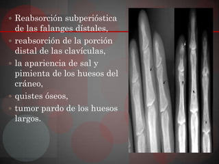  Reabsorción subperióstica
    de las falanges dístales,
   reabsorción de la porción
    distal de las clavículas,
   la apariencia de sal y
    pimienta de los huesos del
    cráneo,
   quistes óseos,
   tumor pardo de los huesos
    largos.
 