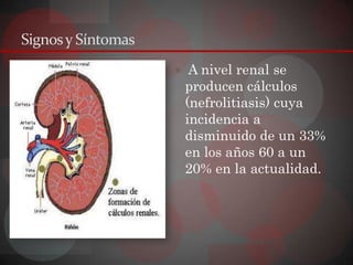 Signos y Síntomas
                     A nivel renal se
                     producen cálculos
                     (nefrolitiasis) cuya
                     incidencia a
                     disminuido de un 33%
                     en los años 60 a un
                     20% en la actualidad.
 