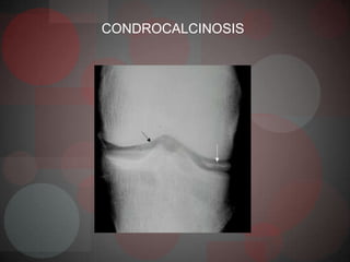 CONDROCALCINOSIS
 