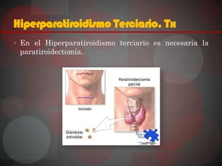 Hiperparatiroidismo Terciario. Tx
 En el Hiperparatiroidismo terciario es necesaria la
 paratiroidectomía.
 