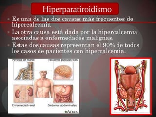 Hiperparatiroidismo
 Es una de las dos causas más frecuentes de
  hipercalcemia
 La otra causa está dada por la hipercalcemia
  asociadas a enfermedades malignas.
 Estas dos causas representan el 90% de todos
  los casos de pacientes con hipercalcemia.

 