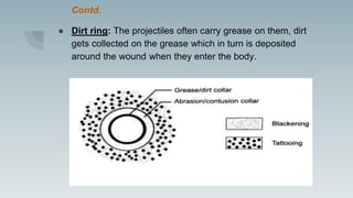 Contd.
● Dirt ring: The projectiles often carry grease on them, dirt
gets collected on the grease which in turn is deposited
around the wound when they enter the body.
 