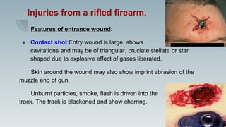 Injuries from a rifled firearm.
Features of entrance wound:
● Contact shot:Entry wound is large, shows
cavitations and may be of triangular, cruciate,stellate or star
shaped due to explosive effect of gases liberated.
Skin around the wound may also show imprint abrasion of the
muzzle end of gun.
Unburnt particles, smoke, flash is driven into the
track. The track is blackened and show charring.
 