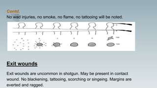 Contd.
No wad injuries, no smoke, no flame, no tattooing will be noted.
Exit wounds
Exit wounds are uncommon in shotgun. May be present in contact
wound. No blackening, tattooing, scorching or singeing. Margins are
everted and ragged.
 