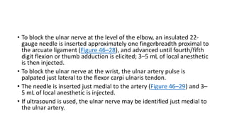 • To block the ulnar nerve at the level of the elbow, an insulated 22-
gauge needle is inserted approximately one fingerbreadth proximal to
the arcuate ligament (Figure 46–28), and advanced until fourth/fifth
digit flexion or thumb adduction is elicited; 3–5 mL of local anesthetic
is then injected.
• To block the ulnar nerve at the wrist, the ulnar artery pulse is
palpated just lateral to the flexor carpi ulnaris tendon.
• The needle is inserted just medial to the artery (Figure 46–29) and 3–
5 mL of local anesthetic is injected.
• If ultrasound is used, the ulnar nerve may be identified just medial to
the ulnar artery.
 