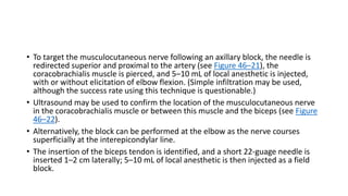 • To target the musculocutaneous nerve following an axillary block, the needle is
redirected superior and proximal to the artery (see Figure 46–21), the
coracobrachialis muscle is pierced, and 5–10 mL of local anesthetic is injected,
with or without elicitation of elbow flexion. (Simple infiltration may be used,
although the success rate using this technique is questionable.)
• Ultrasound may be used to confirm the location of the musculocutaneous nerve
in the coracobrachialis muscle or between this muscle and the biceps (see Figure
46–22).
• Alternatively, the block can be performed at the elbow as the nerve courses
superficially at the interepicondylar line.
• The insertion of the biceps tendon is identified, and a short 22-guage needle is
inserted 1–2 cm laterally; 5–10 mL of local anesthetic is then injected as a field
block.
 