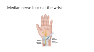 Median nerve block at the wrist
 