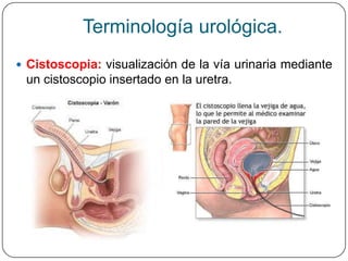 Terminología urológica.
 Cistoscopia: visualización de la vía urinaria mediante
 un cistoscopio insertado en la uretra.
 