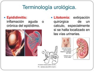 Terminología urológica.
 Epididimitis:            Litotomía:   extirpación
 inflamación aguda o       quirúrgica        de un
 crónica del epidídimo.    calculo, especialmente
                           si se halla localizado en
                           las vías urinarias.
 