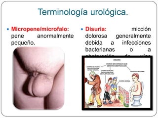 Terminología urológica.
 Micropene/microfalo:    Disuria:         micción
 pene     anormalmente    dolorosa    generalmente
 pequeño.                 debida a infecciones
                          bacterianas      o      a
                          obstrucción    de    vías
                          urinarias.
 