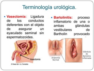 Terminología urológica.
 Vasectomía:   Ligadura     Bartolinitis:  proceso
 de    los    conductos      inflamatorio de una o
 deferentes con el objeto    ambas         glándulas
 de     asegurar      un     vestibulares         de
 eyaculado seminal sin       Bartholin    provocado
 espermatozoides.            por             agentes
                             bacterianos.
 