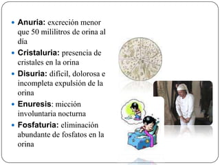  Anuria: excreción menor
    que 50 mililitros de orina al
    día
   Cristaluria: presencia de
    cristales en la orina
   Disuria: difícil, dolorosa e
    incompleta expulsión de la
    orina
   Enuresis: micción
    involuntaria nocturna
   Fosfaturia: eliminación
    abundante de fosfatos en la
    orina
 