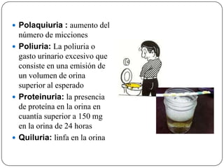 Polaquiuria : aumento del
  número de micciones
 Poliuria: La poliuria o
  gasto urinario excesivo que
  consiste en una emisión de
  un volumen de orina
  superior al esperado
 Proteinuria: la presencia
  de proteína en la orina en
  cuantía superior a 150 mg
  en la orina de 24 horas
 Quiluria: linfa en la orina
 