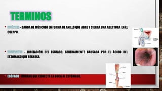 TERMINOS
- BANDA DE MÚSCULO EN FORMA DE ANILLO QUE ABRE Y CIERRA UNA ABERTURA EN EL
CUERPO.
- IRRITACIÓN DEL ESÓFAGO, GENERALMENTE CAUSADA POR EL ÁCIDO DEL
ESTÓMAGO QUE REGRESA.
- ÓRGANO QUE CONECTA LA BOCA AL ESTÓMAGO.
 