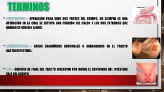 TERMINOS
- OPERACIÓN PARA UNIR DOS PARTES DEL CUERPO. UN EJEMPLO ES UNA
OPERACIÓN EN LA CUAL SE EXTIRPA UNA PORCIÓN DEL COLON Y LOS DOS EXTREMOS QUE
QUEDAN SE VUELVEN A UNIR.
- VASOS SANGUÍNEOS ANORMALES O AGRANDADOS EN EL TRACTO
GASTROINTESTINAL.
- ORIFICIO AL FINAL DEL TRACTO DIGESTIVO POR DONDE EL CONTENIDO DEL INTESTINO
SALE DEL CUERPO.
 