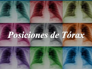 Terminolog a Sobre Posiciones Radiol gicas PPTX terminolog-a-sobre-posiciones-radiol-gicas-pptx