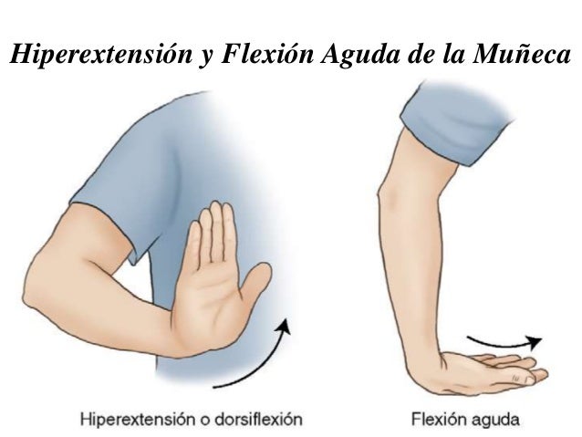 Terminología sobre Posiciones Radiológicas