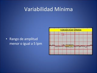 Variabilidad Mínima Rango de amplitud menor o igual a 5 lpm VARIABILIDAD MÍNIMA 