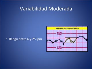 Variabilidad Moderada Rango entre 6 y 25 lpm VARIABILIDAD MODERADA 