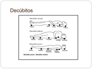 Decúbitos
 