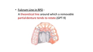 Internal Finish Line Rpd TERMINOLOGIES AND SCOPE IN RPD bds pptx. | PDF
