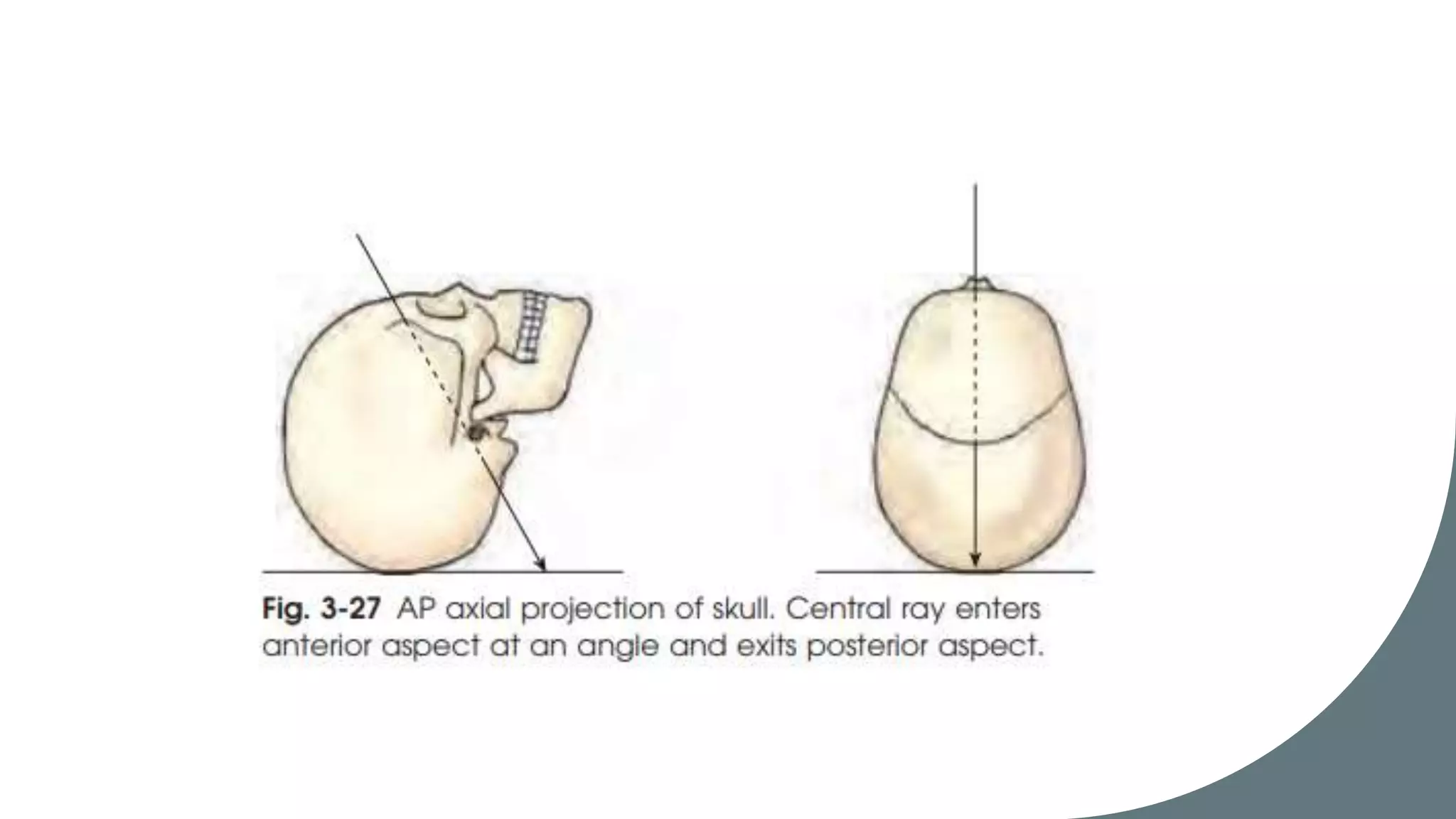 X-ray imaging planes and terminologies | PPTX