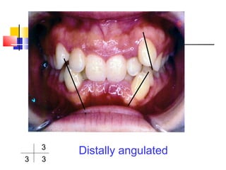 Terminology in Orthodontics | PPT