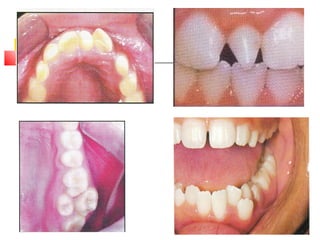 Terminology in Orthodontics | PPT
