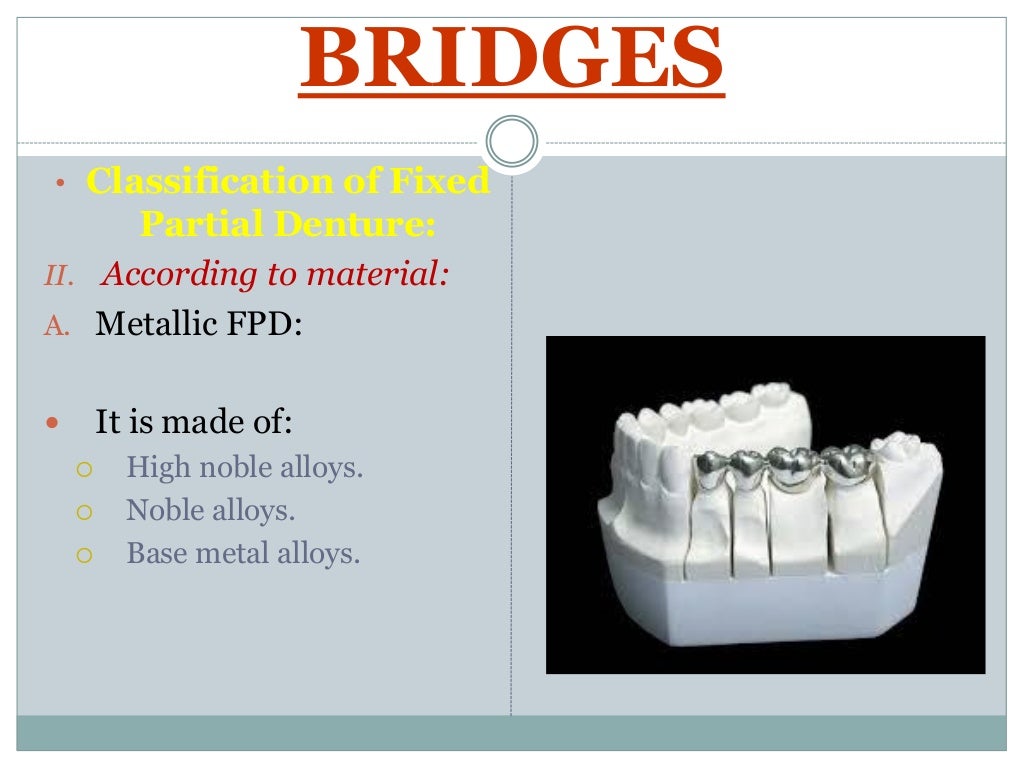 Terminology and classification of fixed prosthodontics