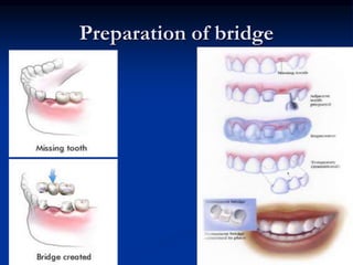 Terminology of dental materials | PPSX