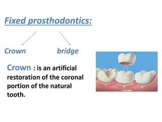 Fixed prosthodontics:
Crown bridge
Crown : is an artificial
restoration of the coronal
portion of the natural
tooth.
 