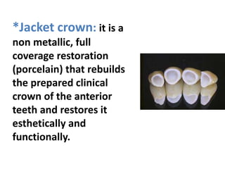 *Jacket crown: it is a
non metallic, full
coverage restoration
(porcelain) that rebuilds
the prepared clinical
crown of the anterior
teeth and restores it
esthetically and
functionally.
 