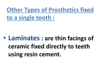 Other Types of Prosthetics fixed
to a single tooth :
• Laminates : are thin facings of
ceramic fixed directly to teeth
using resin cement.
 