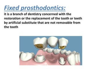 Fixed prosthodontics:
it is a branch of dentistry concerned with the
restoration or the replacement of the tooth or teeth
by artificial substitute that are not removable from
the tooth
 